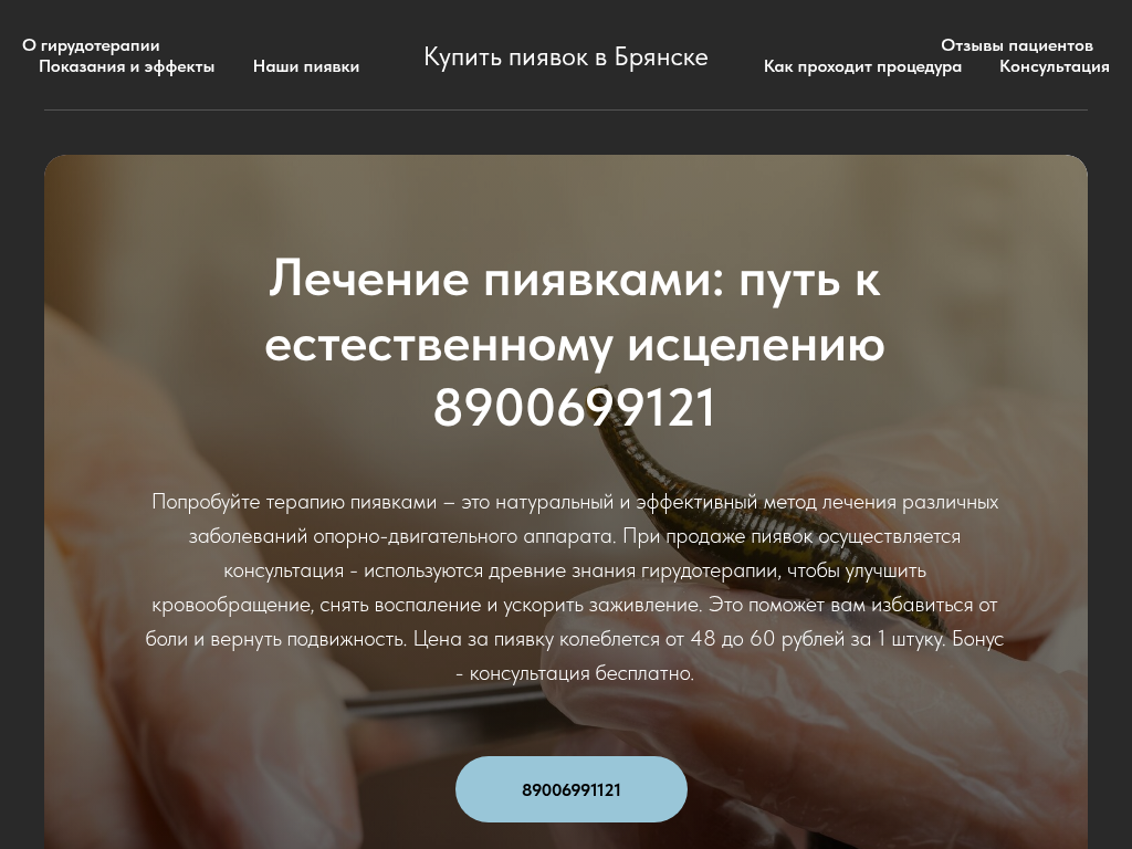 Гирудотерапия: Лечение пиявками для здоровья и хорошего самочувствия