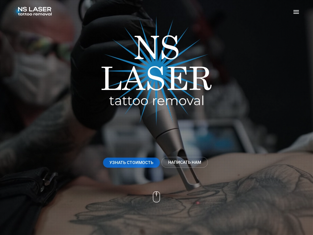Лазерное удаление татуировок